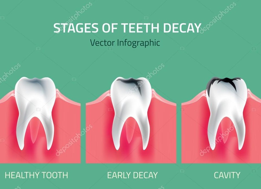 О современной моде на белые зубы и древней японской традиции чернения зубов