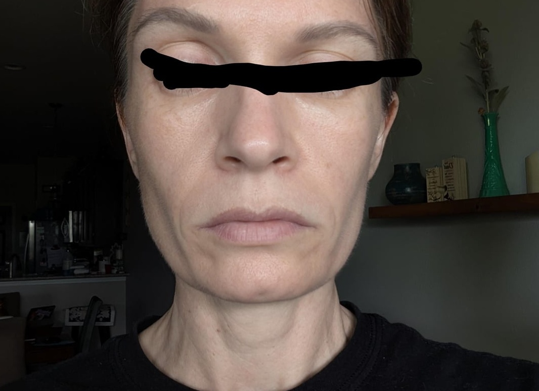 Обратная сторона волшебного косметического преображения героинь разных реалити-шоу