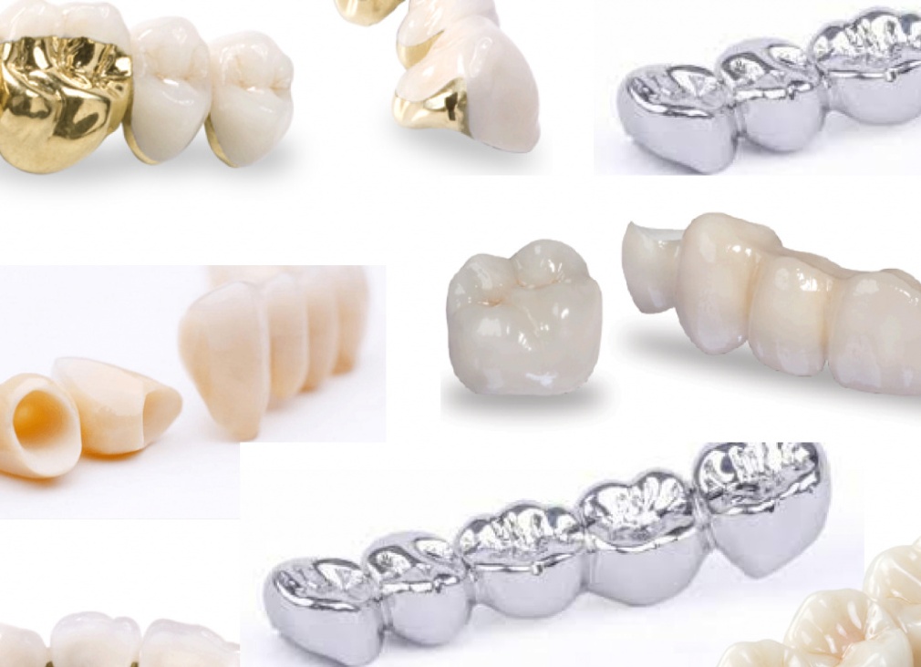 Из каких материалов сегодня делают коронки и почему не из золота и серебра